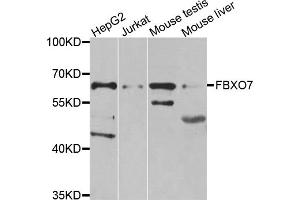 Western blot analysis of extracts of various cell lines, using FBXO7 antibody. (FBXO7 抗体)