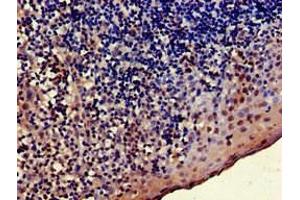 Immunohistochemistry (IHC) image for anti-TNFRSF1A-Associated Via Death Domain (TRADD) (AA 1-312) antibody (ABIN7173904)