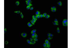 Immunofluorescence (IF) image for anti-Solute Carrier Family 11 (Proton-Coupled Divalent Metal Ion Transporters), Member 2 (SLC11A2) (AA 1-69) antibody (ABIN7161093)