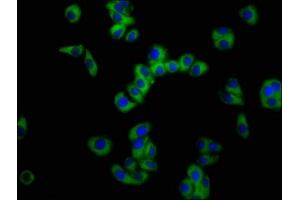 Immunofluorescence staining of HepG2 cells with ABIN7161093 at 1:100, counter-stained with DAPI. (SLC11A2 抗体  (AA 1-69))