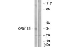 Western blot analysis of extracts from K562 cells, using OR51B6 Antibody.