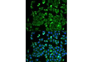 Immunofluorescence analysis of HeLa cells using NF2 antibody.