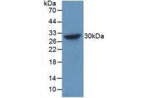 Detection of Recombinant CHGB, Human using Polyclonal Antibody to Chromogranin B (CHGB) (CHGB 抗体  (AA 496-669))