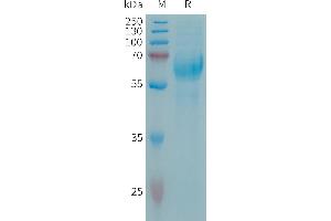 SDS-PAGE (SDS) image for Chondroitin Sulfate Proteoglycan 5 (Neuroglycan C) (CSPG5) (AA 31-420) protein (His tag) (ABIN7538196)