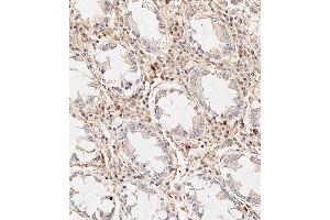 Immunohistochemical analysis of paraffin-embedded human colon tissue using (ABIN389185 and ABIN2839348) performed on the Leica® BOND RXm. (WIF1 抗体  (C-Term))