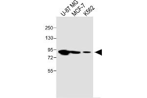 All lanes :PLOD1 Antibody (N-term) at 1:1000 dilution Lane 1: U-87 MG whole cell lysate Lane 2: MCF-7 whole cell lysate Lane 3: K562 whole cell lysate Lysates/proteins at 20 μg per lane. (PLOD1 抗体  (N-Term))