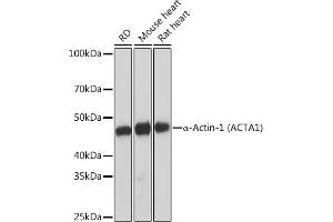 Western blot analysis of extracts of various cell lines, using α-Actin-1  Rabbit mAb (ABIN1682816, ABIN7101454, ABIN7101455 and ABIN7101456) at 1:1000 dilution.
