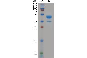 SDS-PAGE (SDS) image for Chemokine (C-X-C Motif) Receptor 2 (CXCR2) (AA 1-48) protein (Fc Tag) (ABIN6964253)