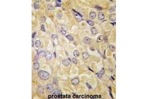 Immunohistochemistry (IHC) image for anti-Frizzled Family Receptor 1 (Fzd1) antibody (ABIN3001613) (FZD1 抗体)