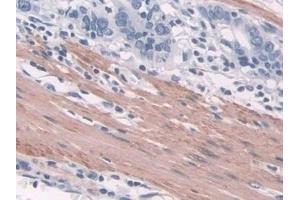 Immunohistochemistry (IHC) image for anti-Transgelin (TAGLN) (AA 1-201) antibody (ABIN7435139)