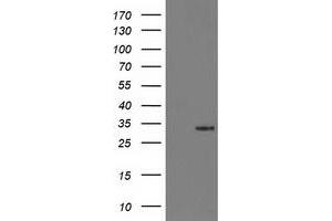 Western Blotting (WB) image for anti-Hydroxyprostaglandin Dehydrogenase 15-(NAD) (HPGD) antibody (ABIN1496363) (HPGD 抗体)