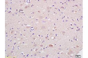 Formalin-fixed and paraffin embedded rat brain labeled with Anti-HSP75/TRAP1 Polyclonal Antibody, Unconjugated (ABIN686647) at 1:200 followed by conjugation to the secondary antibody and DAB staining. (TRAP1 抗体  (AA 501-650))