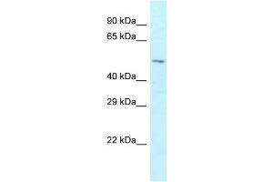 WB Suggested Anti-Zfp872 Antibody Titration: 1.