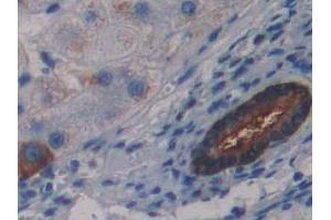 Detection of LSR in Human Liver Tissue using Polyclonal Antibody to Lipolysis Stimulated Lipoprotein Receptor (LSR) (LSR 抗体  (AA 335-589))