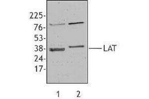 Western Blotting (WB) image for anti-Linker For Activation of T Cells (LAT) antibody (ABIN2666055) (LAT 抗体)
