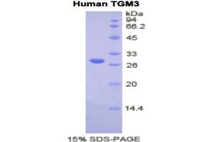 SDS-PAGE analysis of Human TGM3 Protein. (TGM3 蛋白)
