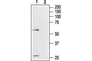 Western blot analysis of rat hippocampus lysate: - 1. (Mu Opioid Receptor 1 抗体  (Extracellular, N-Term))