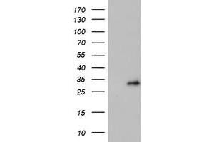 Western Blotting (WB) image for anti-Proteasome (Prosome, Macropain) Subunit, beta Type, 4 (PSMB4) antibody (ABIN1500474) (PSMB4 抗体)
