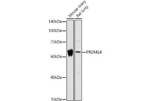 PRDM14 抗体  (AA 1-571)