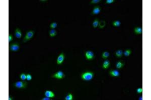 Immunofluorescent analysis of A2780 cells using ABIN7173023 at dilution of 1:100 and Alexa Fluor 488-congugated AffiniPure Goat Anti-Rabbit IgG(H+L) (ANO1 抗体  (AA 1-94))