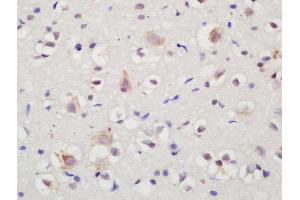 Formalin-fixed and paraffin embedded rat brain labeled with Rabbit Anti-NTR3 Polyclonal Antibody, Unconjugated (ABIN872315) at 1:200 followed by conjugation to the secondary antibody and DAB staining (Sortilin 1 抗体  (AA 731-831))