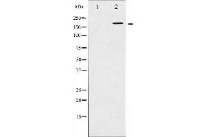 Western blot analysis of HER2 phosphorylation expression in EGF treated SK-OV3 whole cell lysates,The lane on the left is treated with the antigen-specific peptide. (ErbB2/Her2 抗体  (pTyr1248))