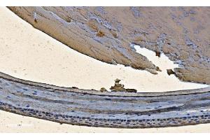 IHC analysis of Alpha B Crystallin/CRYAB using anti-Alpha B Crystallin/CRYAB antibody (ABIN7601209).