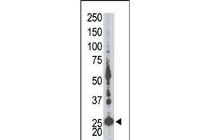 Antibody is used in Western blot to detect AK5 in mouse liver tissue lysate. (Adenylate Kinase 5 抗体  (N-Term))