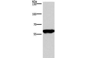 Western Blot analysis of Mouse brain tissue using PPP3CA Polyclonal Antibody at dilution of 1:900 (PPP3CA 抗体)
