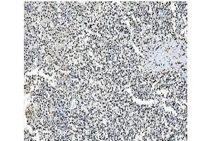 IHC analysis of NRF1 using anti- NRF1 antibody (ABIN7600874).