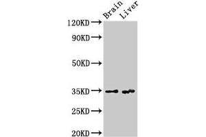 Western Blot Positive WB detected in: Rat brain tissue, Rat liver tissue All lanes: RBKS antibody at 3. (Ribokinase 抗体  (AA 2-322))
