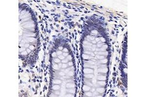 Immunohistochemistry analysis of paraffin-embedded human stomach using,PARN (ABIN7075117) at dilution of 1: 1800 (PARN 抗体)