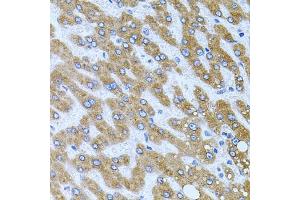Immunohistochemistry (IHC) image for anti-Carboxypeptidase M (CPM) (AA 204-443) antibody (ABIN6138956)