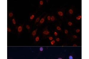 Immunofluorescence analysis of C6 cells using HNRNPU Polyclonal Antibody at dilution of 1:100. (HNRNPU 抗体)
