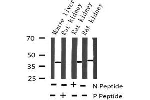 Western blot analysis of Phospho-AMPK β1(Ser181) expression in various lysates