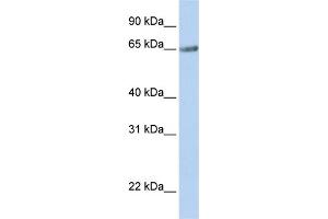 WB Suggested Anti-TM9SF1 Antibody Titration:  0. (TM9SF1 抗体  (N-Term))
