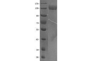 Western Blotting (WB) image for Integrin, alpha 5 (ITGA5) protein (GST tag) (ABIN2713732)