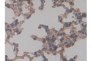 Detection of RAGE in Rat Lung Tissue using Polyclonal Antibody to Receptor For Advanced Glycation Endproducts (RAGE) (RAGE 抗体  (AA 180-402))