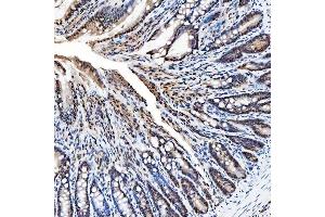 IHC analysis of SNRNP200 using anti-SNRNP200 antibody (ABIN7602032). (SNRNP200 抗体  (AA 557-2129))