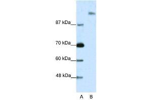 WB Suggested Anti-SUPT6H  Antibody Titration: 2. (Spt6 抗体  (N-Term))