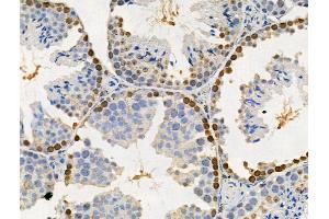 Phospho-SAMHD1 (Thr592) Antibody at 1/100 staining Mouse testis tissue by IHC-P. (SAMHD1 抗体  (pThr592))