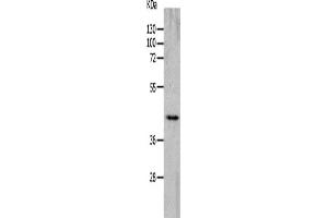 Western Blotting (WB) image for anti-Cholinergic Receptor, Nicotinic, alpha 7 (Neuronal) (CHRNA7) antibody (ABIN2426249) (CHRNA7 抗体)