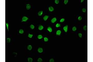 Immunofluorescence (IF) image for anti-Cullin-Associated and Neddylation-Dissociated 1 (CAND1) (AA 1150-1230) antibody (ABIN7148764)