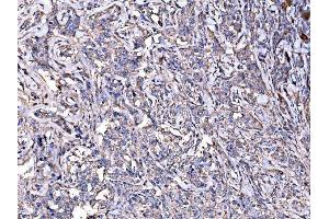 IHC analysis of IMPDH1 using anti-IMPDH1 antibody (ABIN7599864).