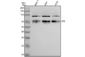 Western blot analysis of RYK using anti-RYK antibody (ABIN7606222).