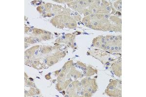 Immunohistochemistry of paraffin-embedded human stomach using FABP5 antibody at dilution of 1:100 (x40 lens). (FABP5 抗体)
