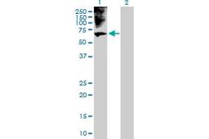 Western Blot analysis of BRF1 expression in transfected 293T cell line by BRF1 MaxPab polyclonal antibody. (BRF1 抗体  (AA 1-473))