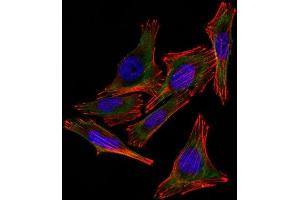 Confocal Immunofluorescent analysis of A2058 cells using AF488-labeled S100B Monoclonal Antibody (4C4. (S100B 抗体)