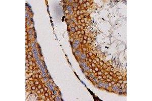 Immunohistochemical analysis of CCL27 staining in human testis formalin fixed paraffin embedded tissue section. (CCL27 抗体)