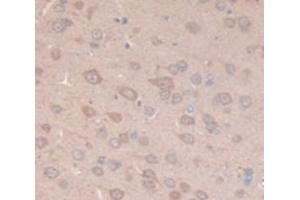 IHC-P analysis of Rat Tissue, with DAB staining. (MGP 抗体  (AA 1-103))